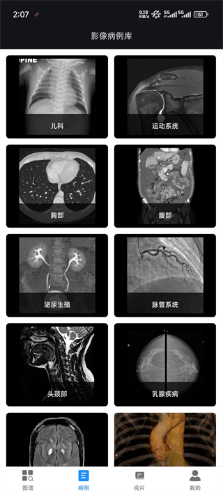 影像解剖图谱